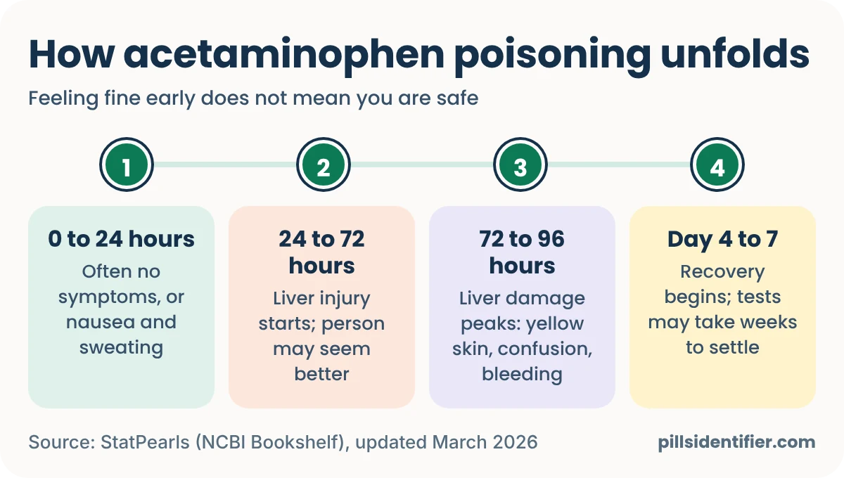 Timeline of acetaminophen poisoning in four stages: 0 to 24 hours, often no symptoms or nausea and sweating; 24 to 72 hours, liver injury starts while the person may seem better; 72 to 96 hours, liver damage peaks with yellow skin, confusion and bleeding; day 4 to 7, recovery begins and tests may take weeks to settle.